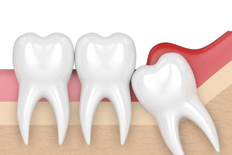 Cirugía Maxilofacial